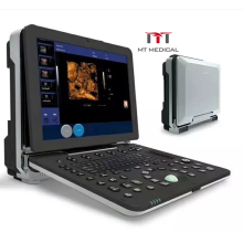 Ten probe optional 128 elements CW 3D/4D portable  color Doppler ultrasound machine